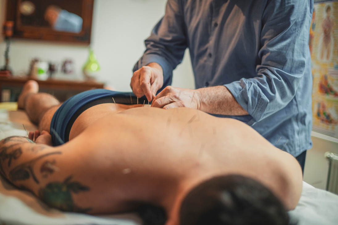 Acupuncture & Trigger Point Needling: Why Trained Acupuncturists Are Essential